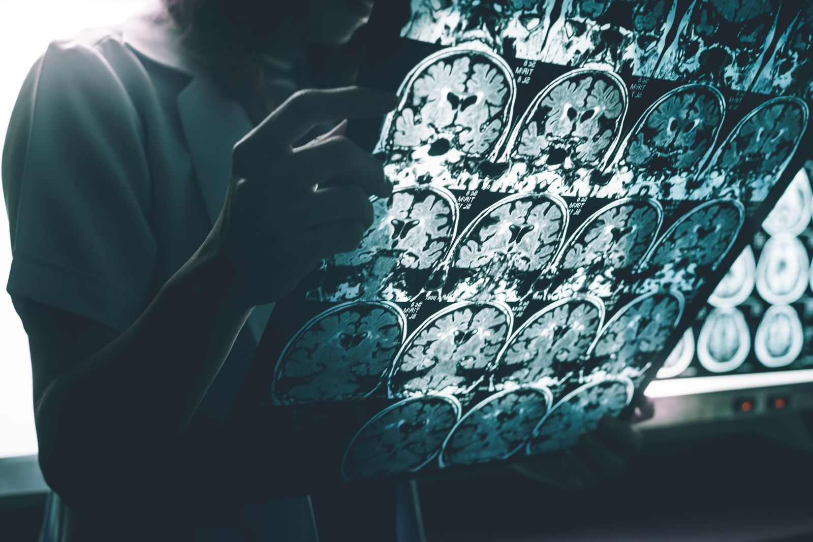 Older adult sleeping peacefully, representing the role of sleep in brain health